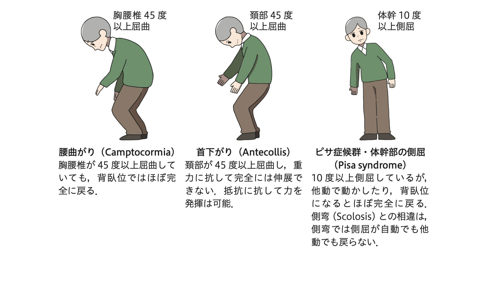 bws症候群 – ITXKRQ